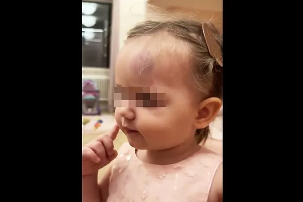 Дочь рэпера ST получила травму: подробности происш...