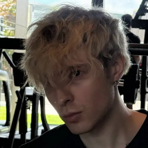 Егор Крид: серьезная травма ноги после п...